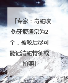专家：毒蛇咬伤牙痕通常为2个，被咬后尽可能记清蛇特征或拍照