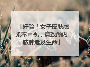 好险！女子皮肤感染不重视，竟致颅内脓肿危及生命